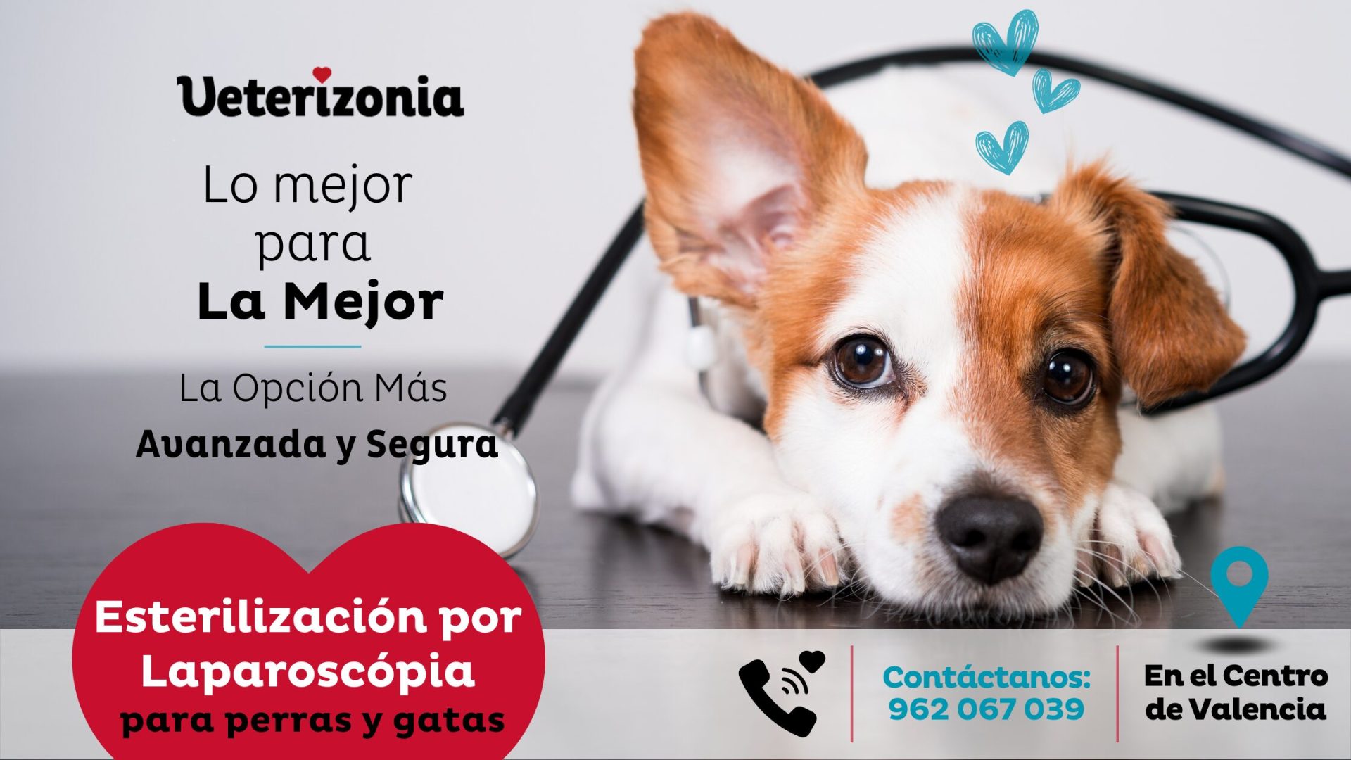 esterilización-por-laparoscopia